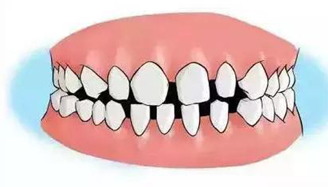 牙齿稀疏牙缝大的男人命运是不是没福气